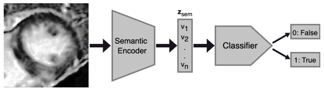 An overview of the process for obtaining a binary prediction from an LGE-CMR image, using the semantic latent representation of the diffusion autoencoder's semantic encoder.